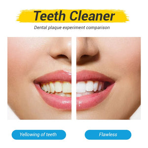 Deep Clean fogkefe(8 darabos készlet)